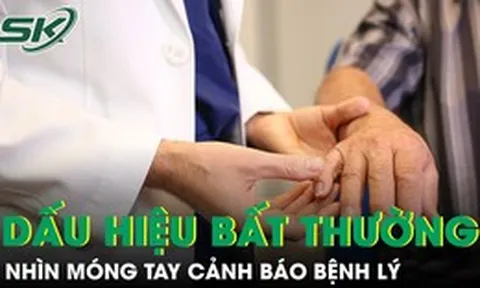 6 dấu hiệu bất thường ở móng tay có thể cảnh báo bệnh lý nguy hiểm