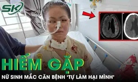 Nữ sinh 19 tuổi mắc căn bệnh 'tự làm hại mình' hiếm gặp
