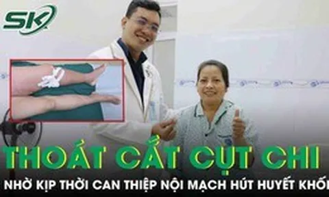 Thoát nguy cơ cắt cụt chi nhờ can thiệp nội mạch hút huyết khối