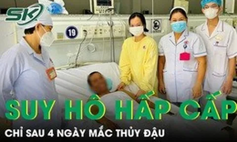 Người đàn ông suy hô hấp cấp chỉ sau 4 ngày mắc thủy đậu