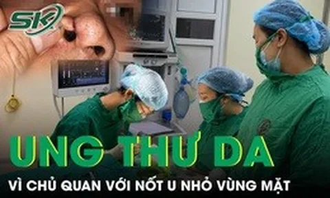 Chủ quan với nốt u nhỏ, người bệnh phát hiện ung thư da vùng mặt