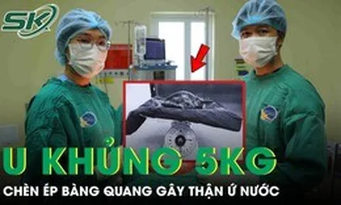 Người phụ nữ 53 tuổi mang khối u xơ tử cung khổng lồ nặng gần 5kg chèn ép bàng quang