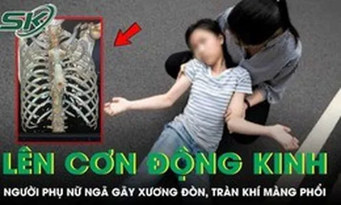 Người phụ nữ ngã gãy xương đòn, tràn máu màng phổi vì lên cơn động kinh
