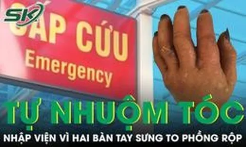 Tự nhuộm tóc tại nhà người đàn ông nhập viện vì hai bàn tay sưng to phồng rộp