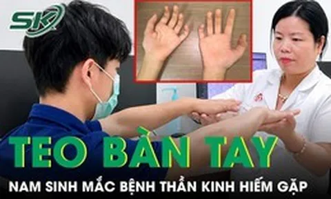 Nam sinh 17 tuổi bàn tay teo nhỏ dần do mắc căn bệnh thần kinh hiếm gặp