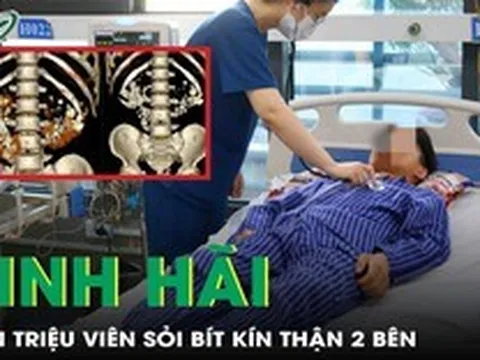 Suýt chạy thận cả đời vì chủ quan khiến hai bên thận ken đặc cả triệu viên sỏi