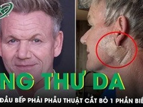 "Vua đầu bếp" Gordon Ramsay phẫu thuật ung thư da, cảnh báo dấu hiệu sớm không được bỏ qua