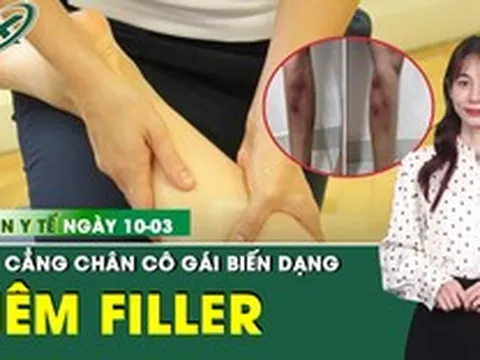 Bản Tin Y Tế 10/3: Tiêm filler để làm thẳng chân, cô gái 29 tuổi biến dạng cẳng chân
