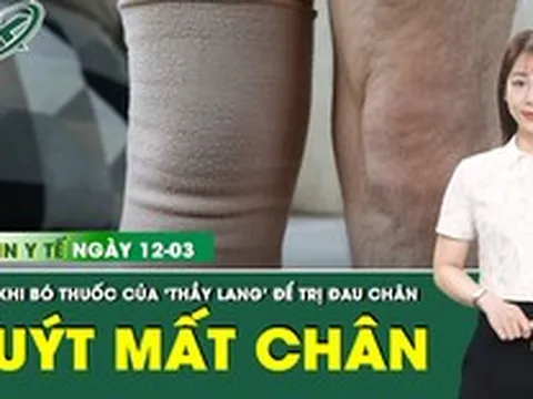 Bản Tin Y Tế 12/3: Suýt mất chân sau khi đến 'thầy lang' bó thuốc