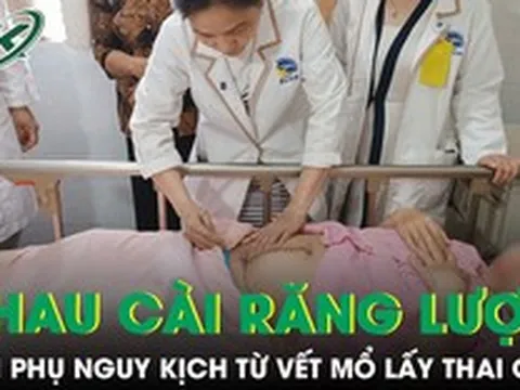 Cứu sản phụ và thai nhi khỏi nguy kịch do nhau cài răng lược trên vết mổ lấy thai cũ
