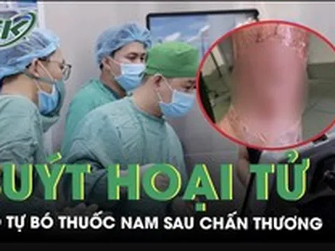 Tự bó thuốc nam sau chấn thương, người đàn ông viêm mô bào suýt hoại tử