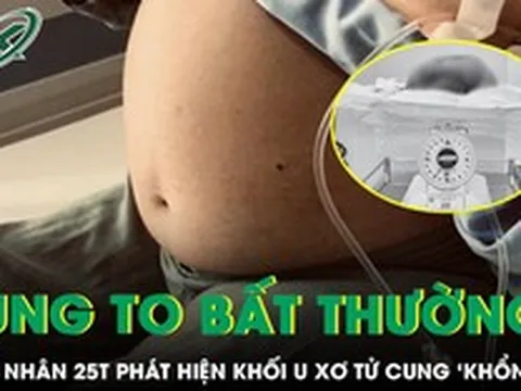 Bóc tách thành công khối u xơ tử cung “khổng lồ” cho nữ bệnh nhân 25 tuổi