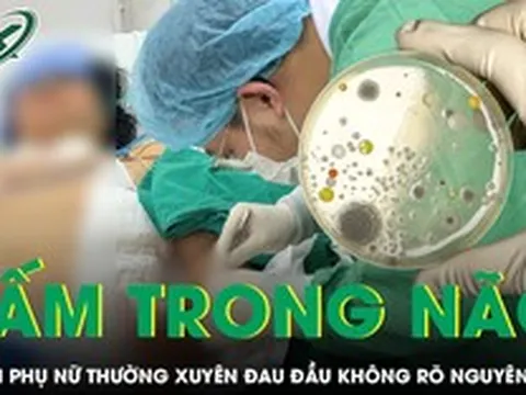 Đau đầu nhiều ngày, người phụ nữ bất ngờ phát hiện nấm nguy hiểm trong não