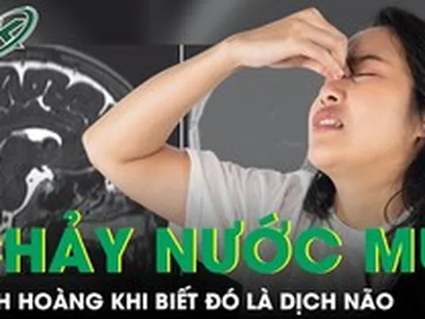 Sổ mũi nhiều ngày, người phụ nữ kinh hoàng khi biết đó là dịch não