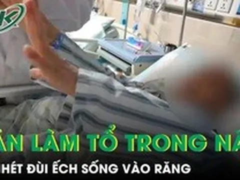 Nhét đùi ếch sống vào răng, người phụ nữ 61 tuổi bị sán ký sinh, làm tổ trong não