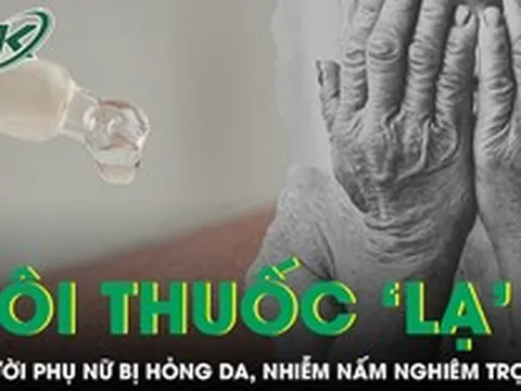 Người phụ nữ bị hỏng da, nhiễm nấm nghiêm trọng sau khi bôi "thuốc lạ"