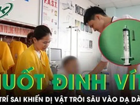 Bé 21 tháng tuổi nuốt đinh vít, người nhà xử trí sai cách khiến dị vật trôi sâu vào dạ dày