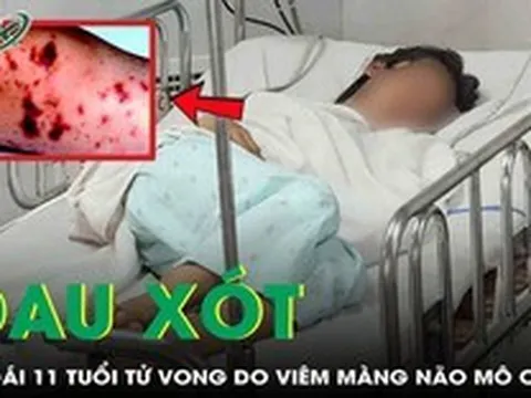 Đau xót: Bé gái 11 tuổi tử vong do viêm màng não mô cầu thể tối cấp