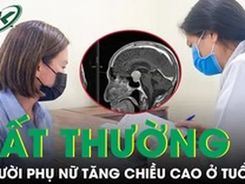 Người phụ nữ tăng chiều cao bất thường ở tuổi 40