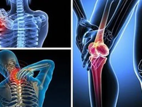 Không vận động mạnh tại sao vẫn bị thoái hoá?