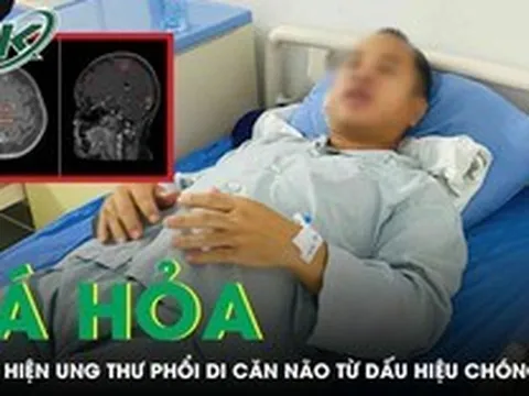 Người đàn ông tá hỏa phát hiện ung thư phổi di căn não từ dấu hiệu chóng mặt