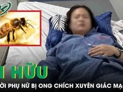 Ong chích xuyên giác mạc, người phụ nữ sưng phù mắt phải cấp cứu khẩn