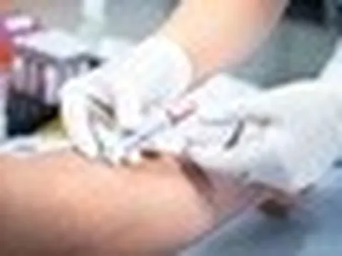Bất cứ ai có 5 dấu hiệu này cần xét nghiệm máu ngay
