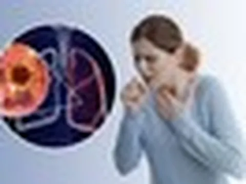 Không hút thuốc vẫn bị ung thư phổi: 2 yếu tố hầu như ai cũng gặp mỗi ngày