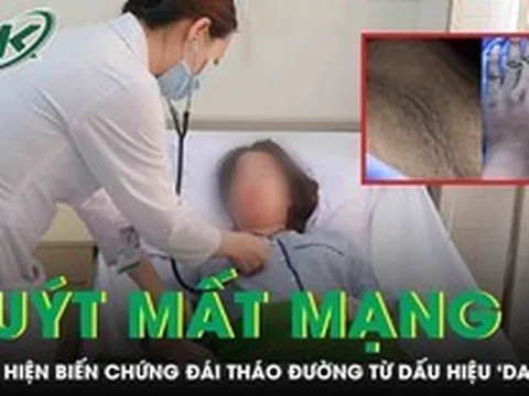 Tưởng da bẩn, cô gái 20 tuổi suýt mất mạng vì biến chứng đái tháo đường