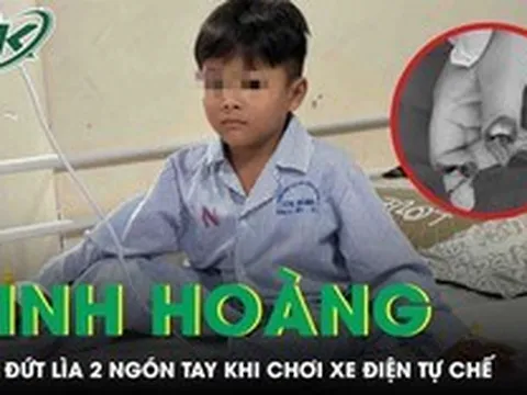 Kinh hoàng: Bé trai 5 tuổi đứt lìa 2 ngón tay khi chơi xe điện tự chế