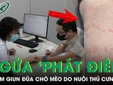Ngứa ‘phát điên’, người đàn ông đi khám phát hiện nhiễm giun đũa chó mèo