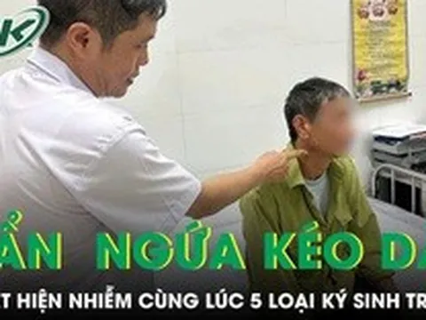 Ngứa suốt nửa năm, người đàn ông phát hiện nhiễm cùng lúc 5 loại ký sinh trùng