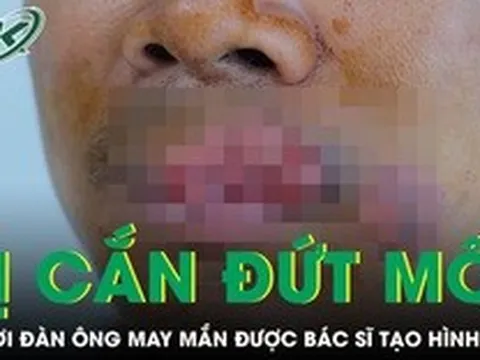 Người đàn ông bị cắn mất môi phải trải qua ca tạo hình phức tạp