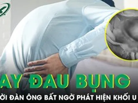 Thỉnh thoảng đau bụng, người đàn ông bất ngờ phát hiện khối u 3kg