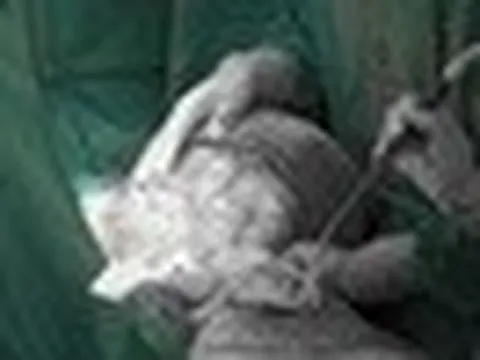 Bụng to như mang thai 9 tháng, người phụ nữ phát hiện thứ khủng khiếp bên trong