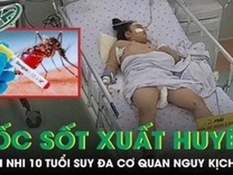 Sốc sốt xuất huyết, bệnh nhi 10 tuổi suy đa cơ quan, tổn thương gan cấp tính nguy kịch