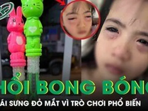 Chơi bong bóng xà phòng, bé gái 5 tuổi sưng đỏ 2 mắt phải cấp cứu khẩn