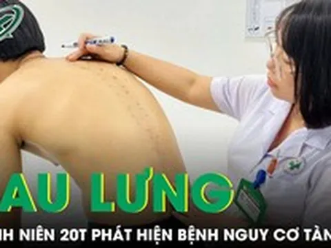 Tưởng đau lưng do tập gym, nam thanh niên 20 tuổi phát hiện mắc bệnh nguy cơ gây tàn phế