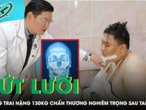 Cứu chàng trai nặng 130 kg đứt lưỡi sau tai nạn giao thông