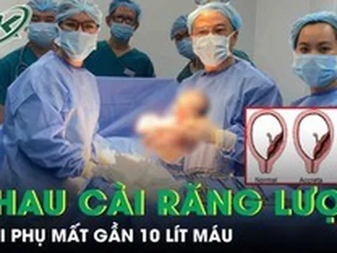Thai phụ 36 tuần mất gần 10 lít máu, nguy hiểm tính mạng vì tai biến nhau cài răng lược