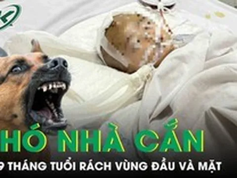 Chó nhà cắn, bé 19 tháng tuổi rách sâu vùng đầu và mặt phải cấp cứu