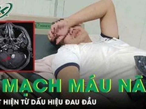 Nam thanh niên phát hiện u mạch máu não xuất huyết từ dấu hiệu đau đầu
