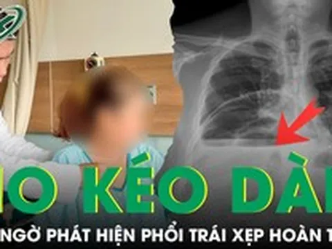 Ho kéo dài nhiều tuần, người phụ nữ bất ngờ phát hiện phổi trái xẹp hoàn toàn vì bệnh hiếm