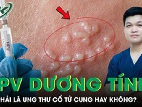 Có phải HPV dương tính là bị ung thư cổ tử cung không?