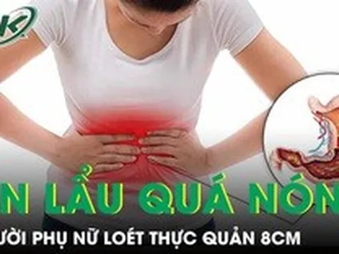 Người phụ nữ loét thực quản 8cm vì thói quen ăn lẩu quá nóng