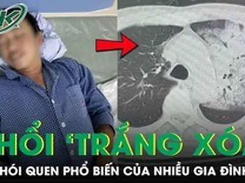 Tưởng cảm cúm, người đàn ông bất ngờ suy đa tạng, phổi ‘trắng xoá’ vì thói quen nhiều người mắc