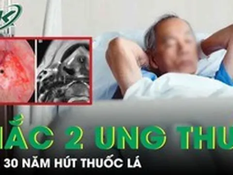 Người đàn ông 56 tuổi mắc cùng lúc hai ung thư sau 30 năm hút thuốc lá