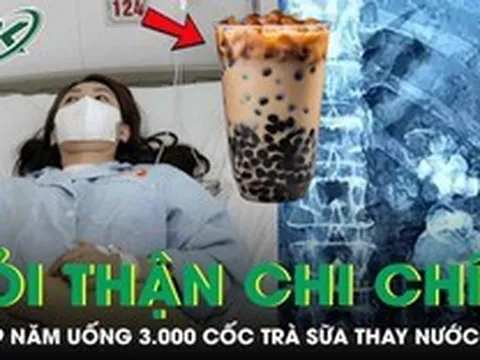 Uống 3.000 cốc trà sữa thay nước lọc suốt 9 năm, thận cô gái mọc chi chít sỏi