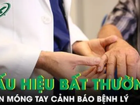 6 dấu hiệu bất thường ở móng tay có thể cảnh báo bệnh lý nguy hiểm