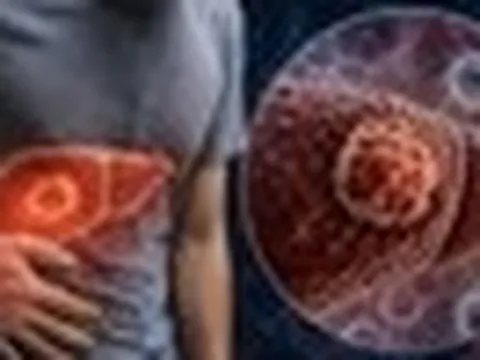 5 dấu hiệu sớm của ung thư gan dễ lộ ngay ở vùng bụng, nhiều người Việt lại tưởng chỉ là tăng cân bình thường